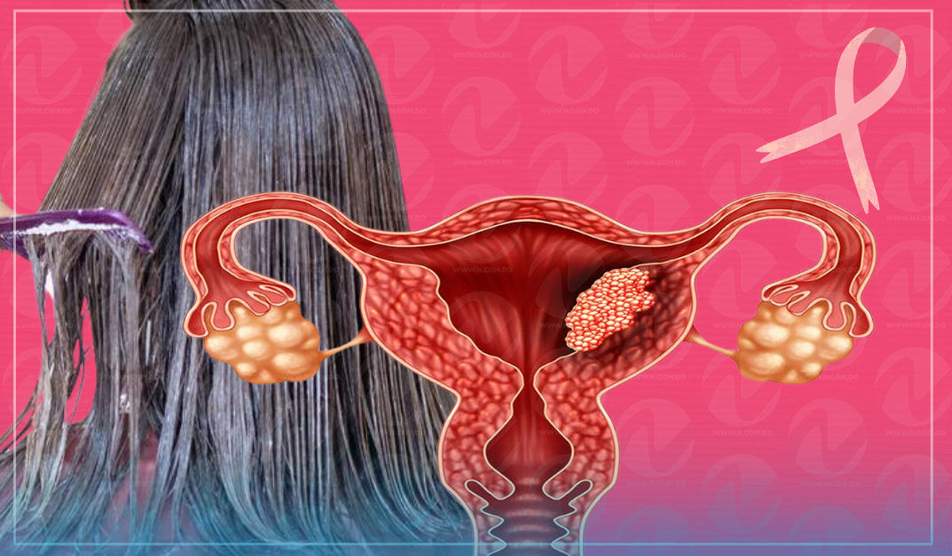 Alisados para el pelo causan cáncer de endometrio